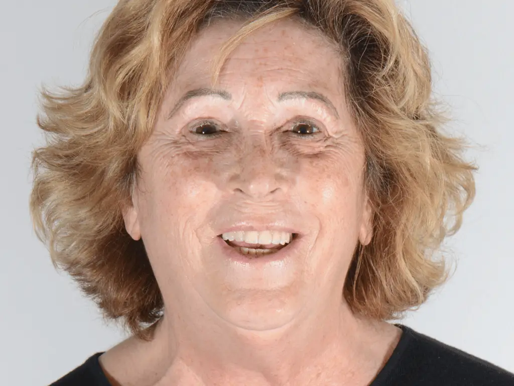 ZAGA Center Clinical Case Expert in zygomatic implants