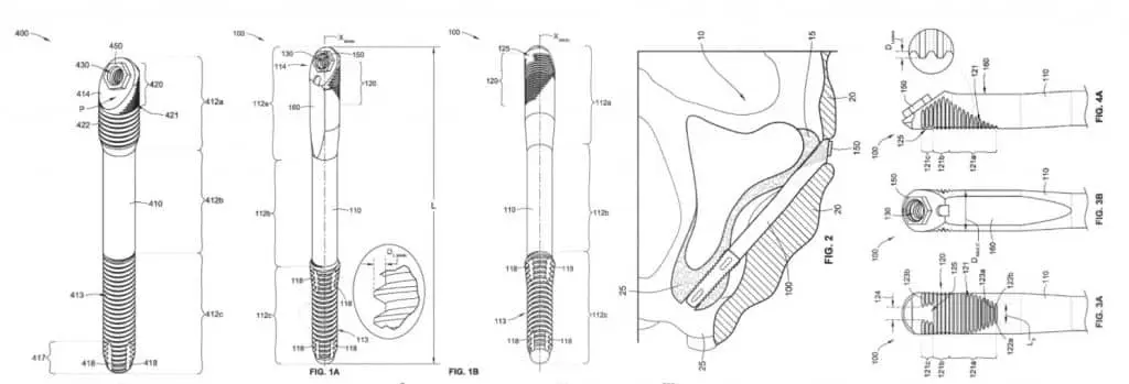 Graphic of the patent of the Zygomatic Implants created by Dr. Carlos Aparicio.