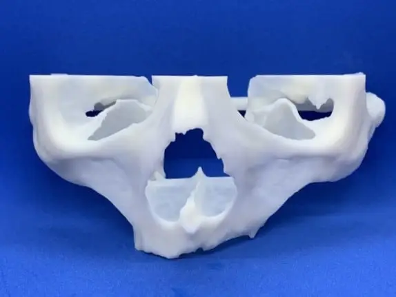 3D dental model for zygomatic implants