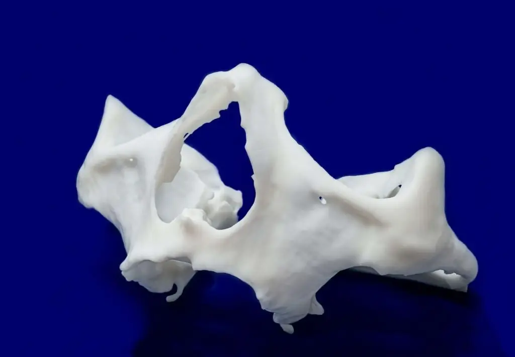 3D Model ZAGA Zygomatic