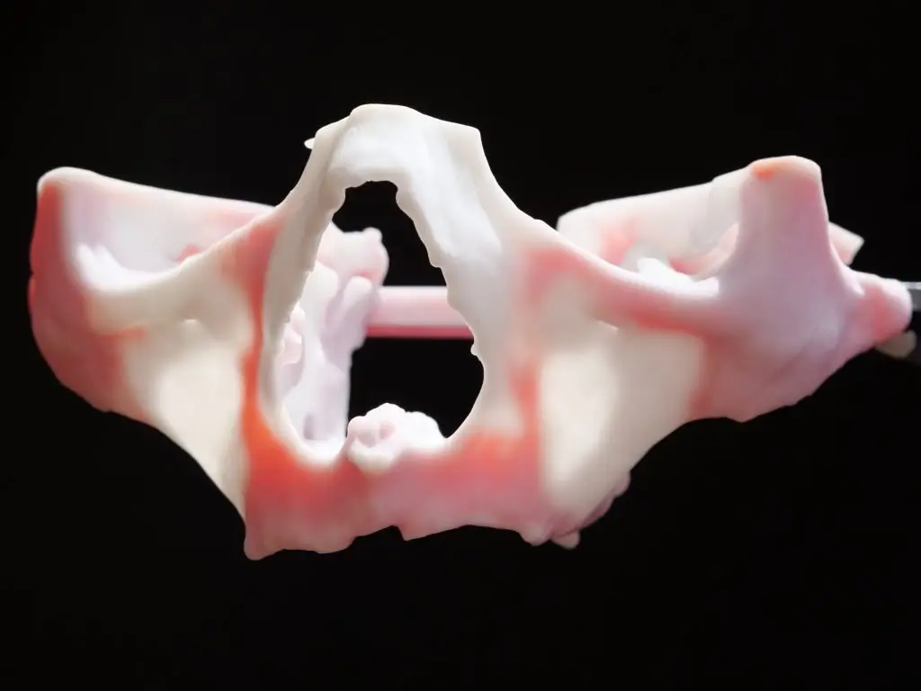 Dental 3D Model with Blood 43