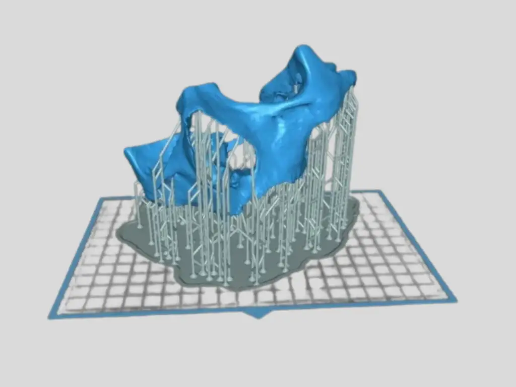 STL File of 3D Dental Model