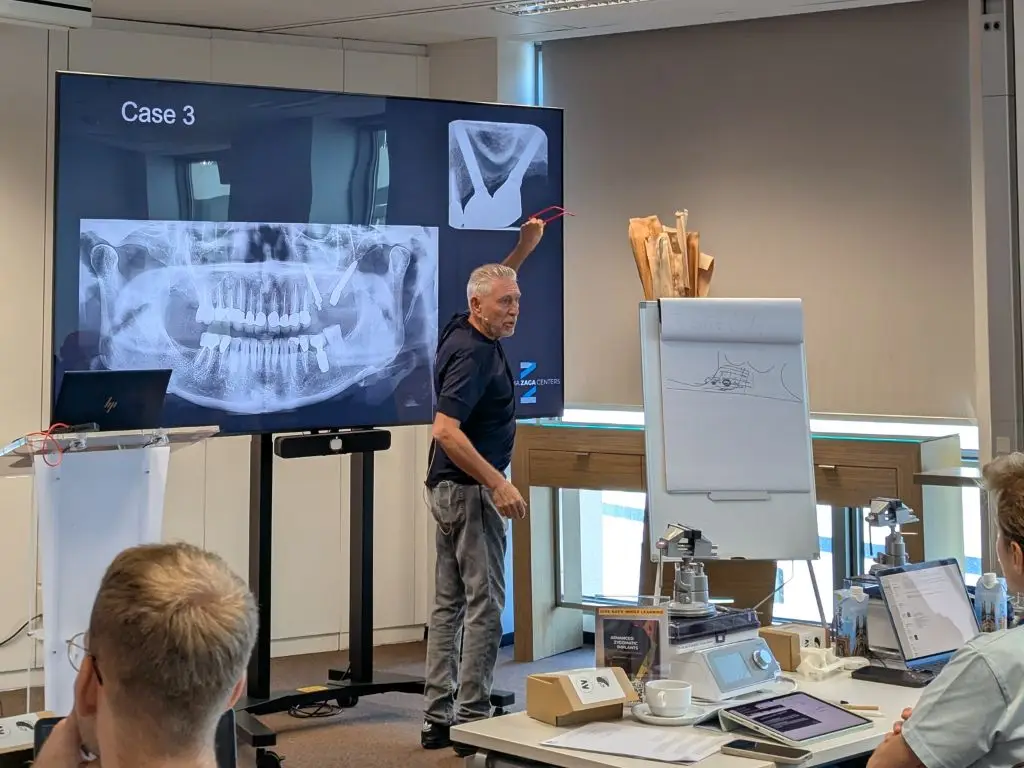 Dr. Adi Lorean during his Pterygoid Implants Session