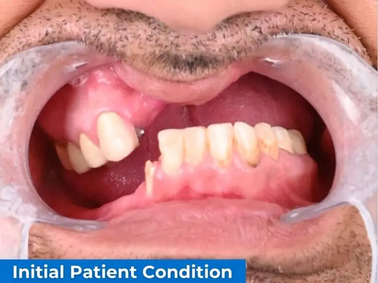 Dr Russo - Initial Patient Condition