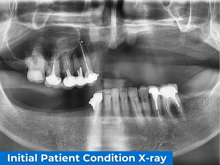 Dr Russo - Initial Patient Condition X-ray